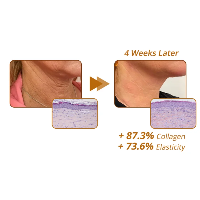 Snow Lotus Bubble Anti-Aging Wrinkle-Reducing Blackhead Removal Mask - Image 10