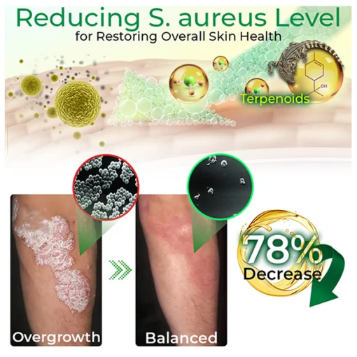 GFOUK™ Crócil Crocodile Oil Repair Aleppo Soap - Image 6