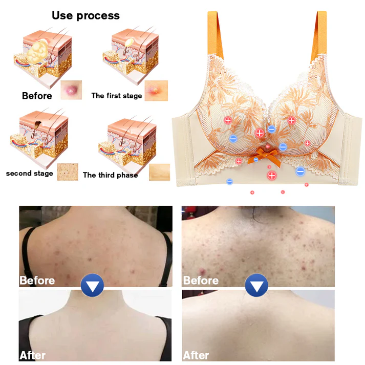 ๐๐๐ข๐๐ฎ๐ข๐ฌโข ๐๐๐ ๐๐ข๐ฅ๐ค ๐๐จ๐ง ๐๐จ๐ซ๐ซ๐๐๐ญ๐ข๐ฏ๐ ๐๐ฒ๐ฆ๐ฉ๐ก๐๐ญ๐ข๐ ๐๐ซ๐๐ข๐ง๐๐ ๐ ๐๐ซ๐ - Image 5