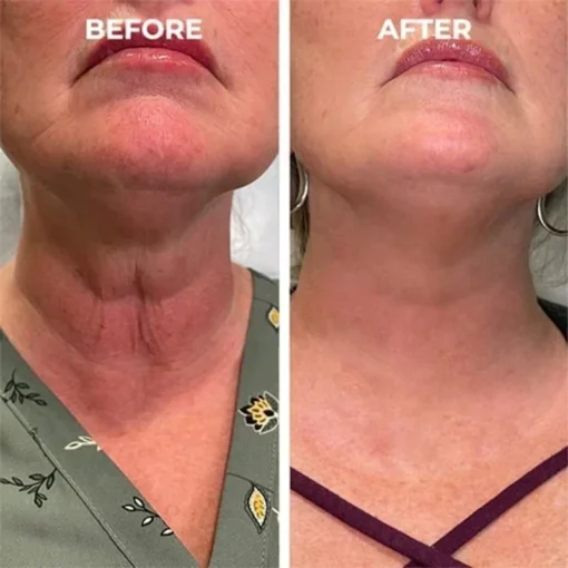PEPTIDE Wrinkle Reducing Cream - Image 5