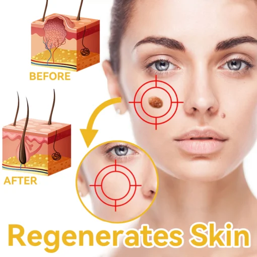 DOCTIA™ Bee Venom Medical Grade Scar Remove Advanced Gel - Image 9