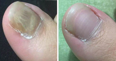 Ceoerty™ ComfreyBoost Nail Repair Serum - Ofbylding 7