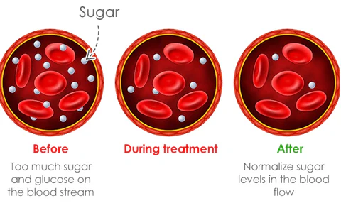 Healthlux™ Sugar Regulator Bangle - Ofbylding 31