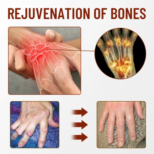 Ceoerty™ Bone Soothing Turmeric Therapy Spray - Image 7