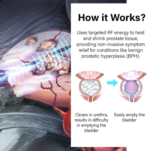 Oveallgo™ ProstateFlow RF Therapy Band - Image 8