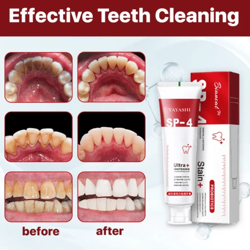 Biancat™ SP-4 Stain Removal & Whitening Toothpaste - Image 4