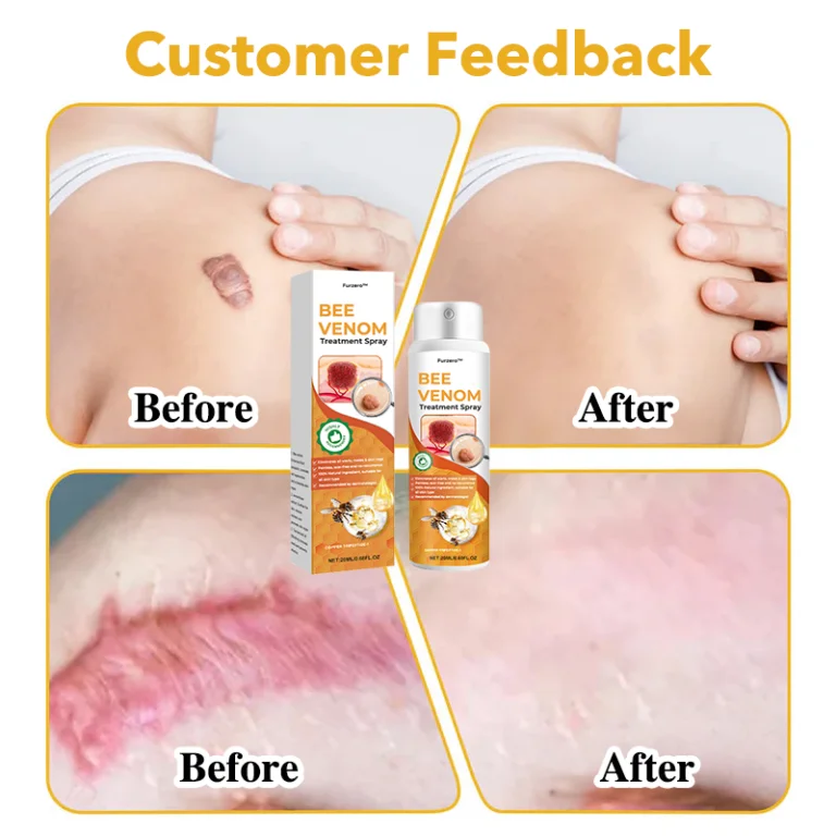 Furzero™ Bee Venom Therapy Spray - Image 8