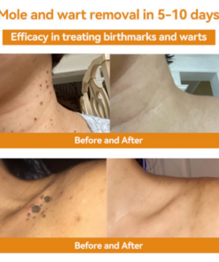 Alternative view of flysmus™ Bee Venom Skin Treatment Cream