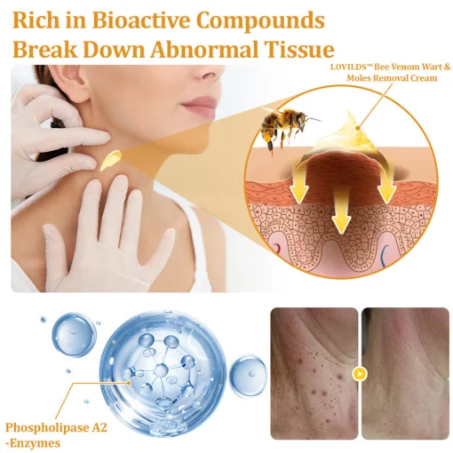 LOVILDS™ TagCure Bee Venom Wart & Moles Removal Cream - Image 6