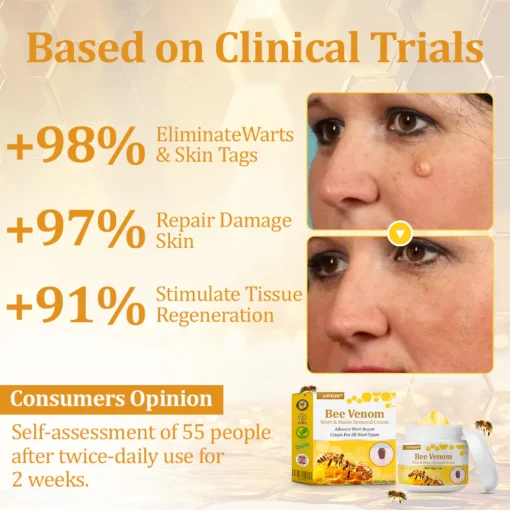 LOVILDS™ TagCure Bee Venom Wart & Moles Removal Cream - Image 4