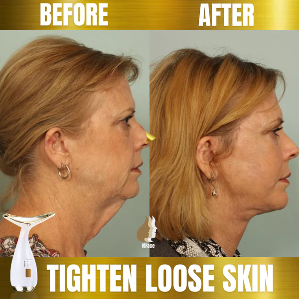 Seurico™-7-in-1 Facelift Wand - Image 3