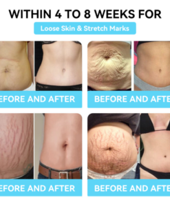 Alternative view of VOCJFEI™ Bee Venom lon Fat- Burning Detox Icy Silk Shapewear