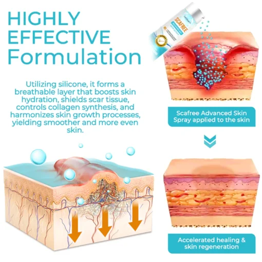 EdiJonah™ Advance Scar Care Formula - Ofbylding 3