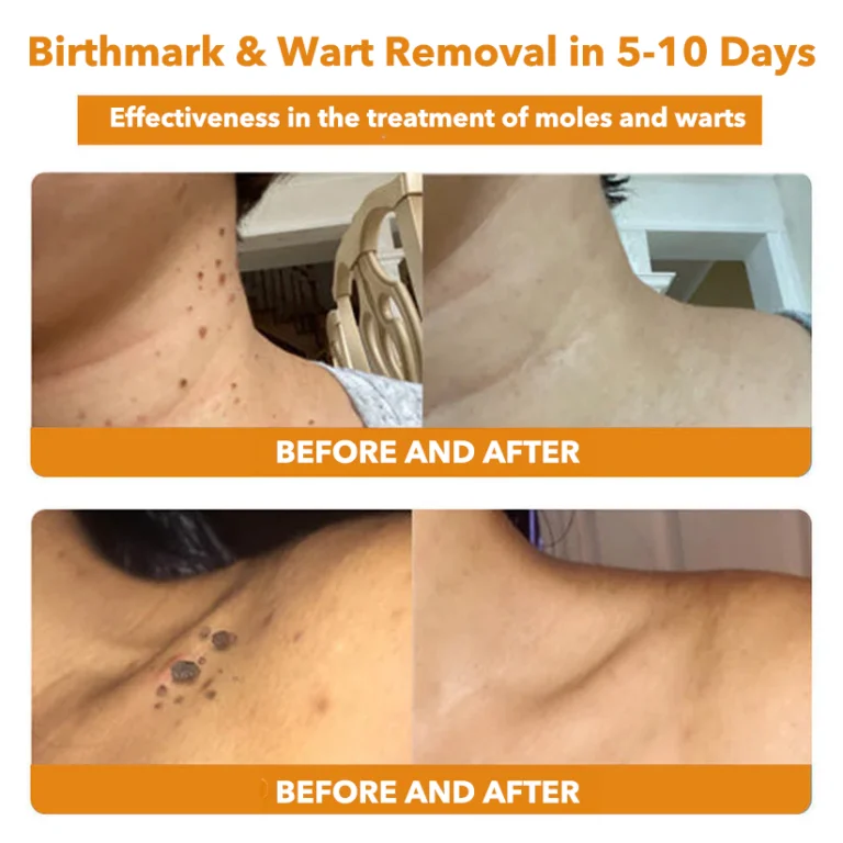 Furzero™ Bee Venom Therapy Spray - Image 5