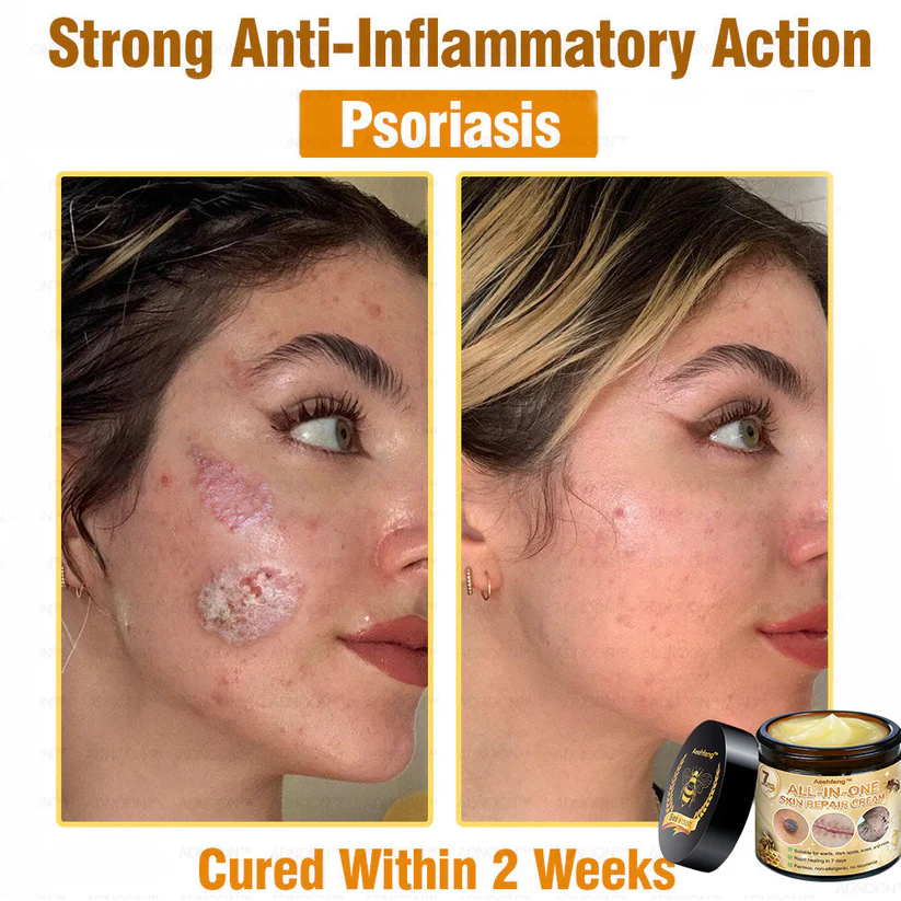 Aeehfeng™ 7-Day Rapid Skin Repair Cream makes your skin smoother and healthier.