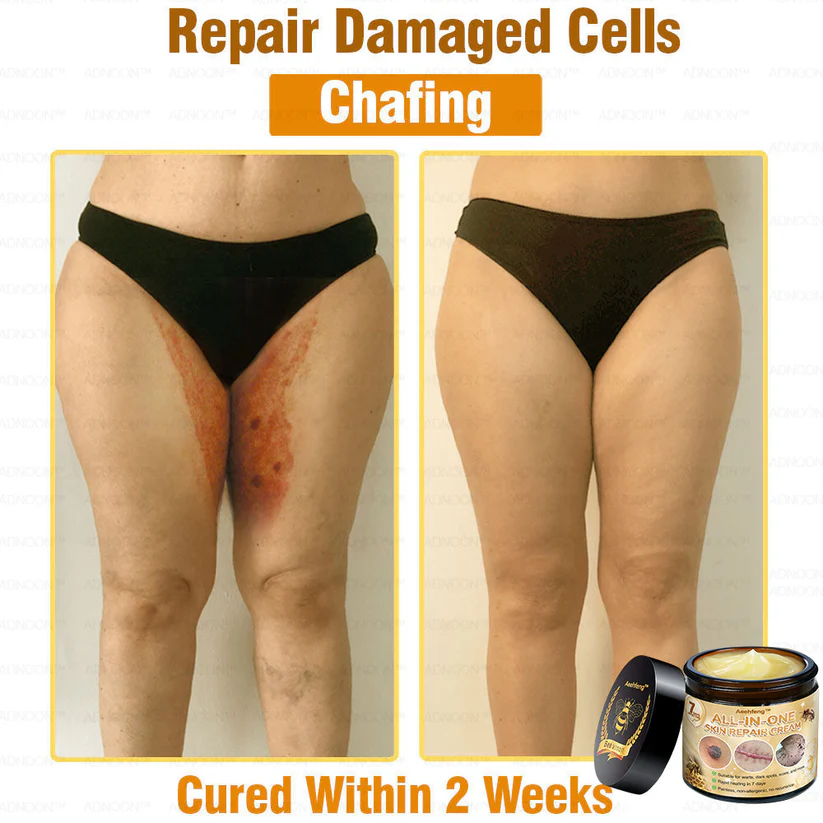 Soothe and repair irritated skin with Aeehfeng™ 7-Day Rapid Skin Repair Cream.