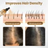 Biancat™ Biotin Hair Growth Premium Serum activates hair follicles and accelerates growth.