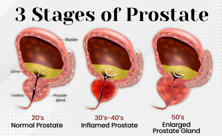 Ceoerty™ BeeFlowAir Nasal Inhaler provides natural support for prostate health.