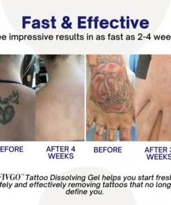 Fivfivgo™ Tattoo Vanishing Gel