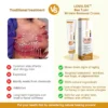 LOVILDS™ Bee Toxin Wrinkle Removal Cream rejuvenates your skin.