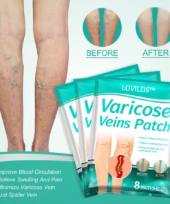 LOVILDS™ Leech Varicose Veins Patch helps reduce concerns related to varicose veins.