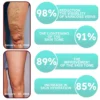 LOVILDS™ Leech Varicose Veins Patch helps treat and reduce varicose veins.