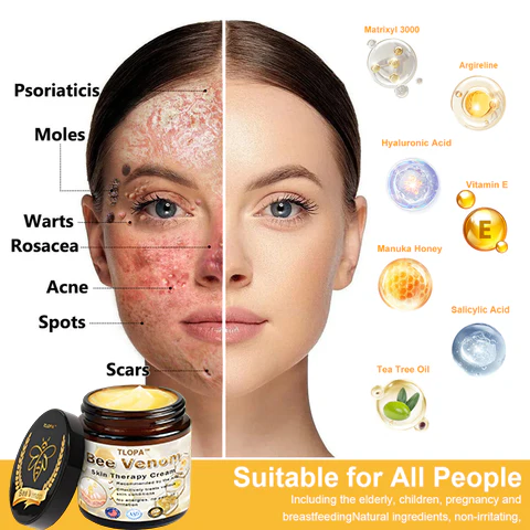 TLOPA™ Powerful All-Body Skin Treatment Cream effectively reduces wrinkles and age spots.