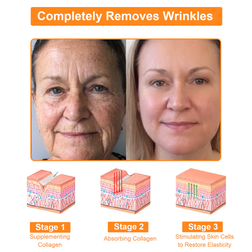 TLOPA™ Powerful All-Body Skin Treatment Cream boosts skin elasticity for a smoother appearance.