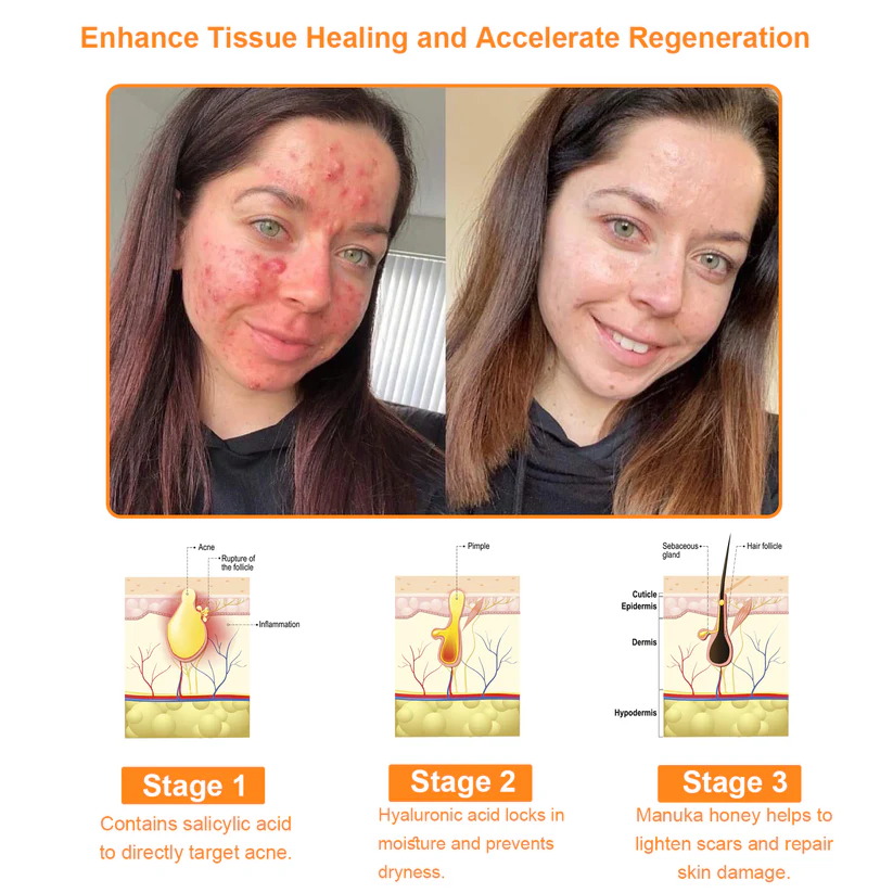 TLOPA™ Powerful All-Body Skin Treatment Cream nourishes and revitalizes the skin.