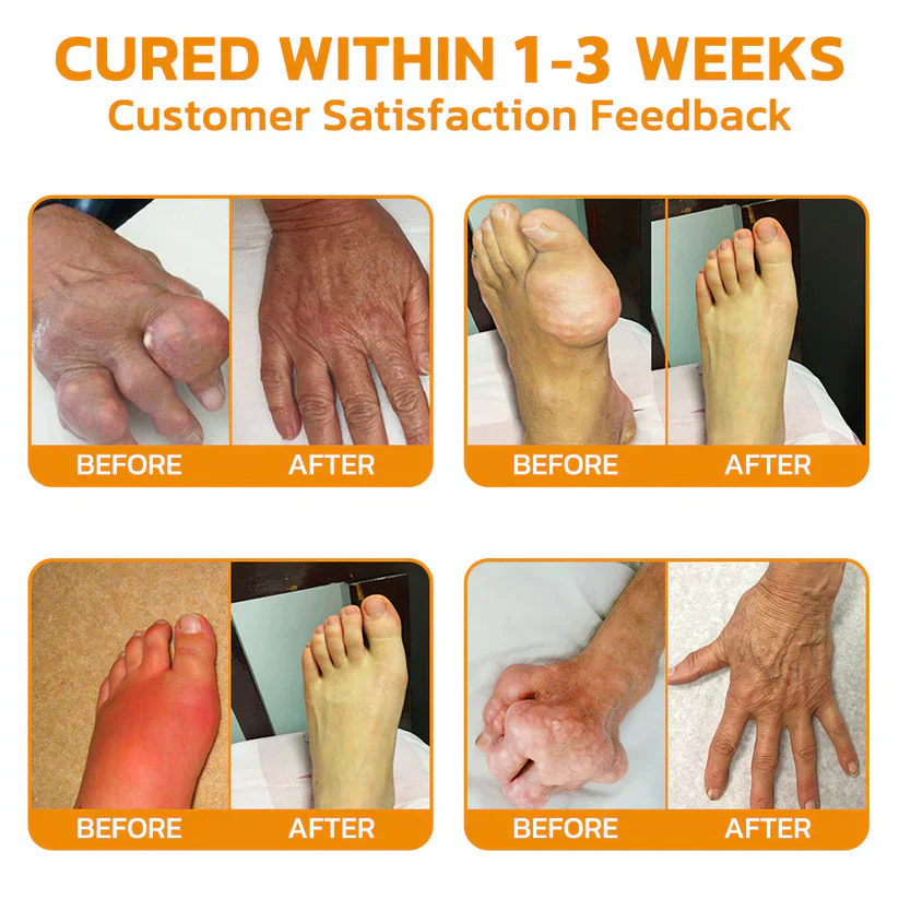 flysmus™ Lidocaine 5Mins Pain Relief Healing Spray is a powerful pain and inflammation solution.