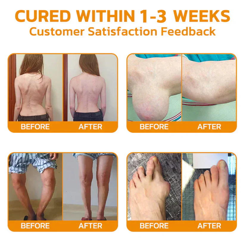 Fight arthritis with flysmus™ Lidocaine 5Mins Pain Relief Healing Spray.