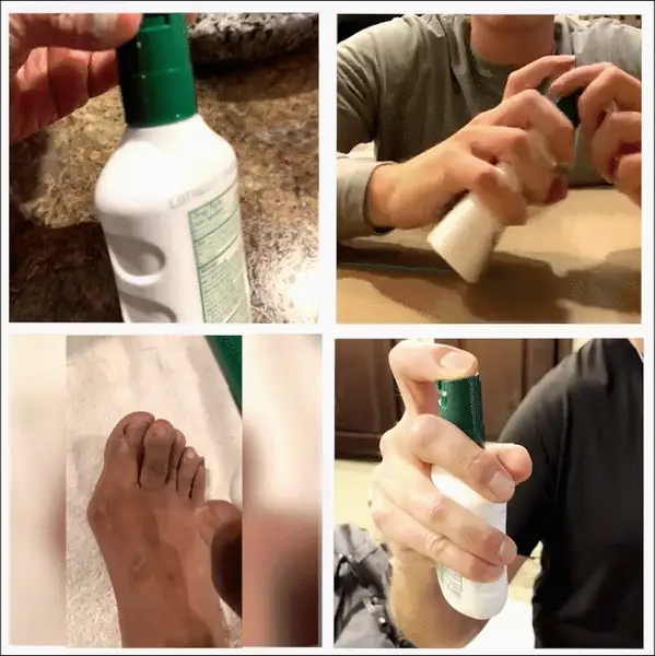 flysmus™ Lidocaine 5Mins Pain Relief Healing Spray reduces inflammation instantly.