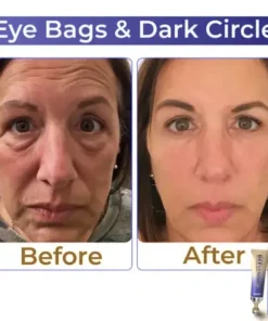 BBOJI™ Collagen+ Bee Venom Roller Eye Cream