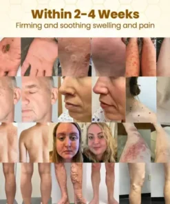 Biancat™ BeeDerma Repair Cream