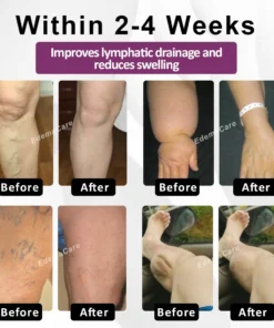 DetoxFlow™ EdemaRelief Lymphatic Detox Cream