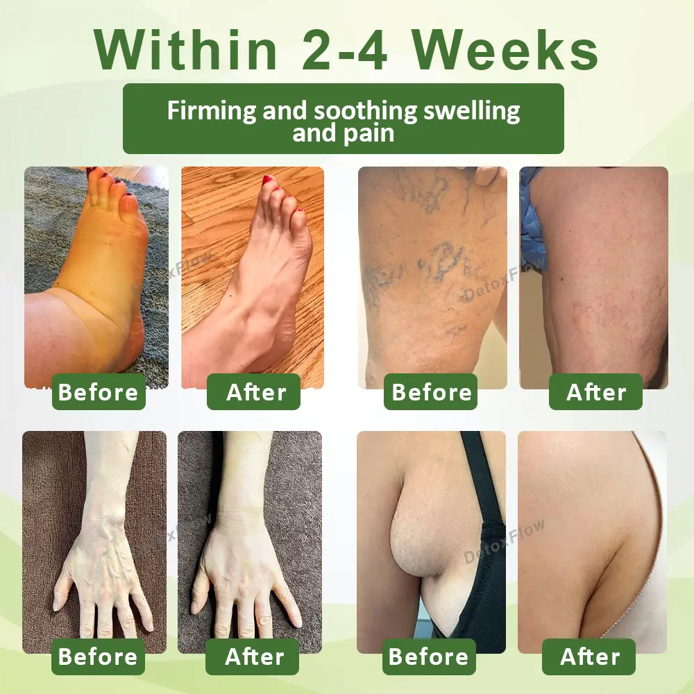 DetoxFlow ™ uachdar luibheil lymphatic gun swell