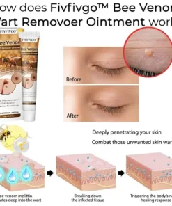Fivfivgo™ Bee Venom Wart Remover Ointment