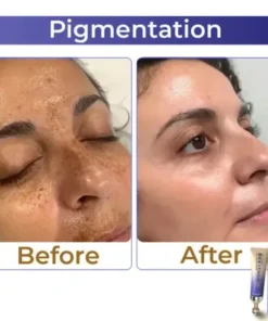 GarageLine™ Collagen+Bee Venom Roller Eye Cream