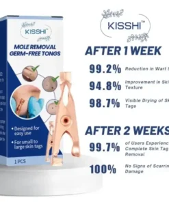 KISSHI™ Mole Removal Germ-Free Tongs
