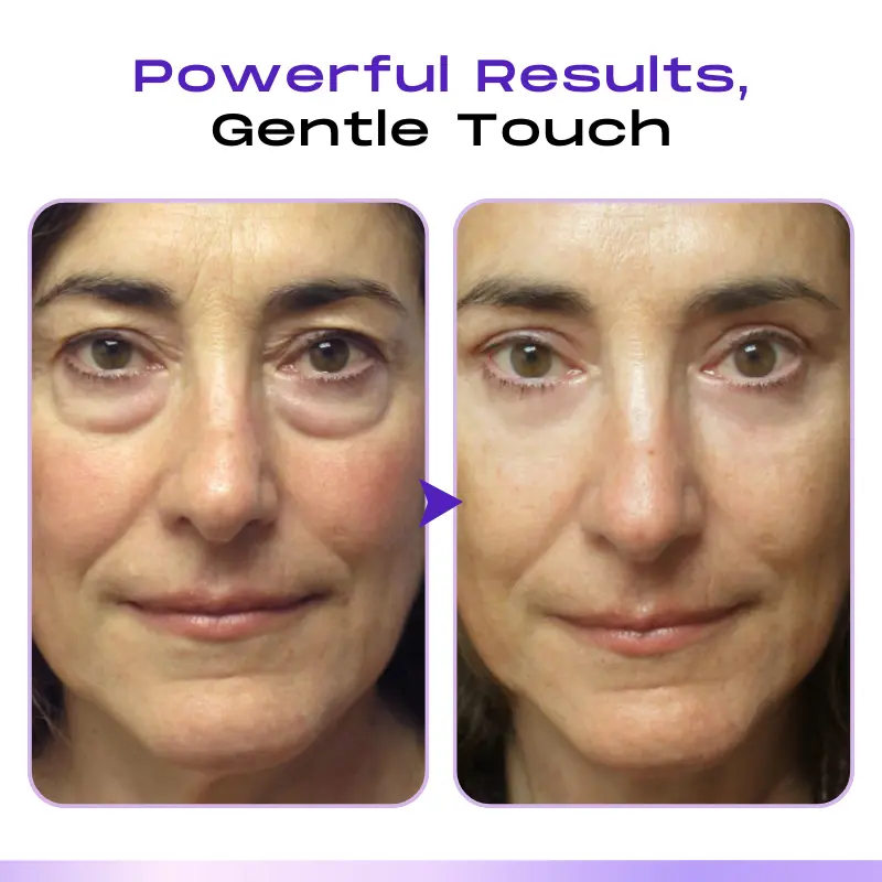 LOVILDS ™ CollagenVen Bee Venom Eye Roller Serum