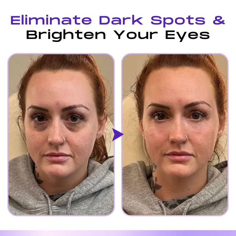 LOVILDS ™ CollagenVen Bee Venom Eye Roller Serum