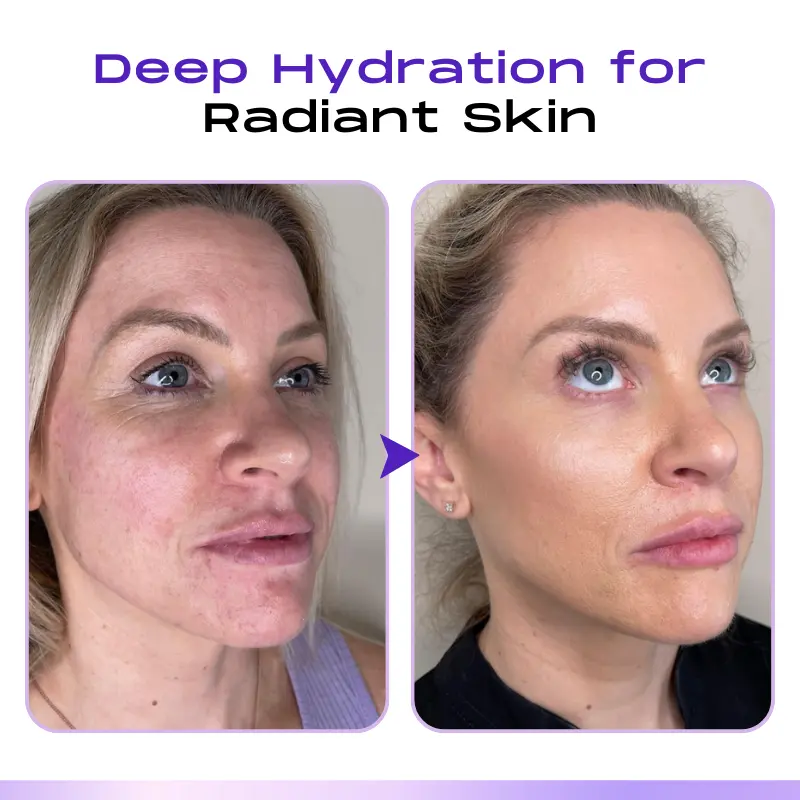 LOVILDS ™ CollagenVen Bee Venom Eye Roller Serum