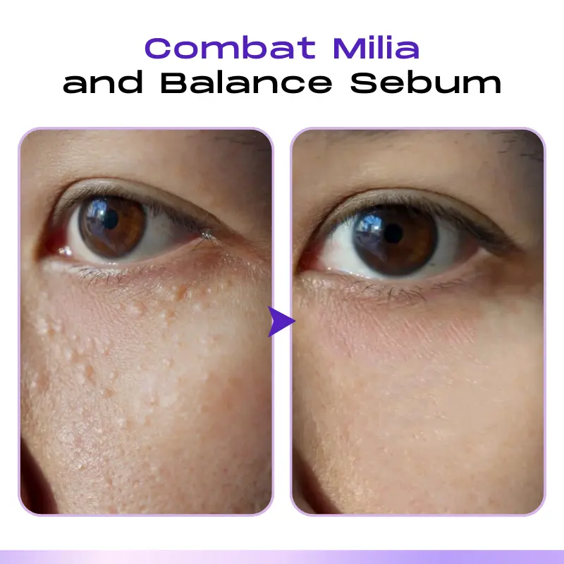 LOVILDS ™ CollagenVen Bee Venom Eye Roller Serum