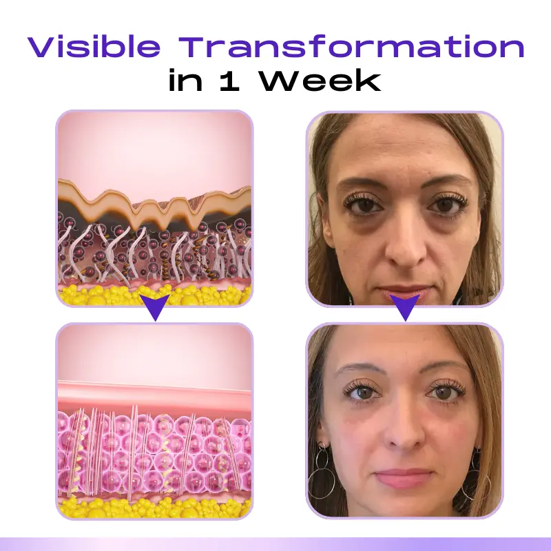 LOVILDS ™ CollagenVen Bee Venom Eye Roller Serum