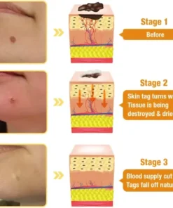 LOVILDS™ TagRecede Bee Venom Treatment Spray