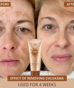 𝑷𝒂𝒓𝒐𝒘𝒖™️ 𝑾𝒉𝒊𝒕𝒆𝒏𝒊𝒏𝒈 𝒂𝒏𝒅 𝑺𝒑𝒐𝒕-𝑹𝒆𝒎𝒐𝒗𝒊𝒏𝒈 𝑭𝒂𝒄𝒆 𝑴𝒂𝒔𝒌