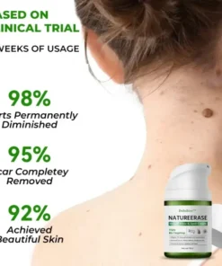 ✅ Official Store: Dobshow™ NatureErase Instant Mole & Spot Cream