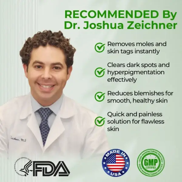 ✅ Official Store: Dobshow™ NatureErase Instant Mole & Spot Cream