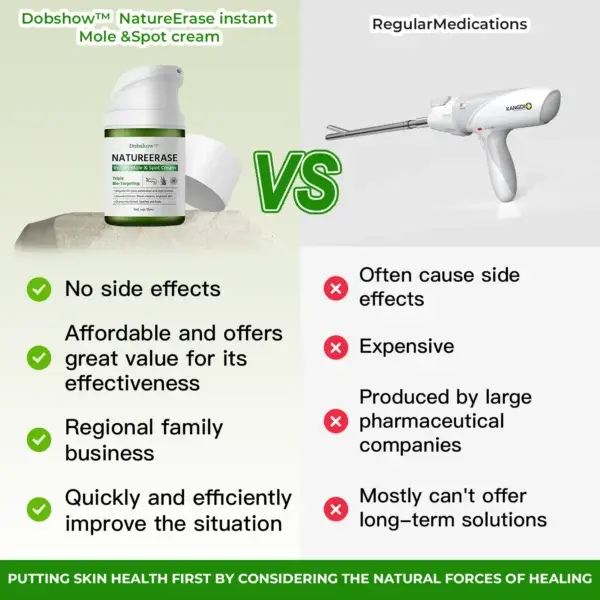 ✅ Official Store: Dobshow™ NatureErase Instant Mole & Spot Cream