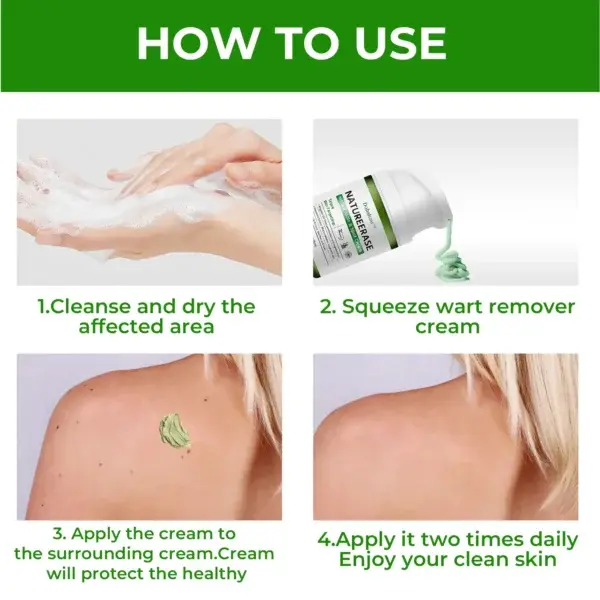 ✅ Official Store: Dobshow™ NatureErase Instant Mole & Spot Cream